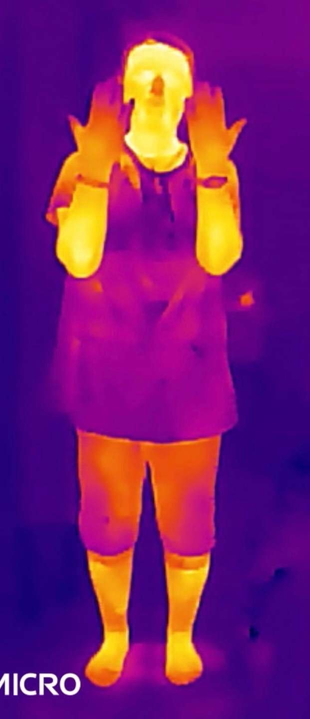 水素吸入前のサーモグラフィ画像